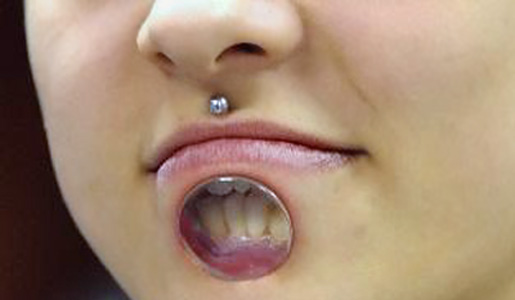 Bodymodification – Extremer Trend: Lippentunnel (+English version)